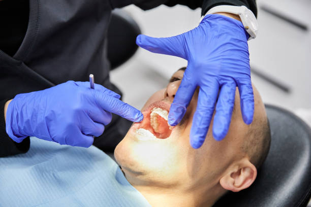 Best Emergency Dental Extractions in Jacinto City, TX